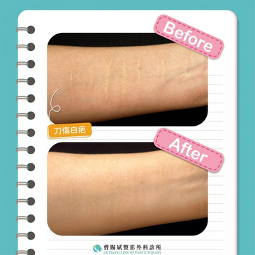 Slider image (4) Dr. Tsao Clinic of Plastic Surgery